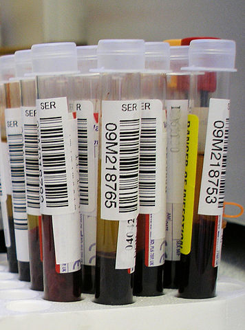 356px-Blood_test