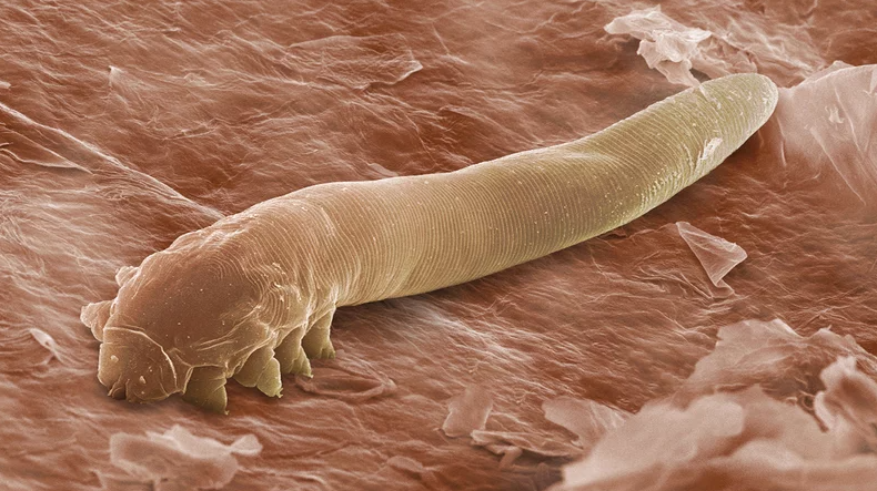 Demodex 